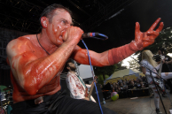 HAEMORRHAGE